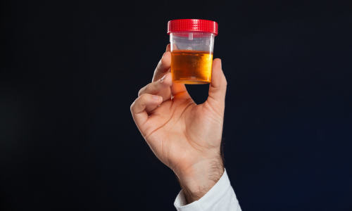 Urine Related Problems