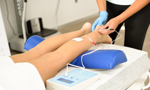 Varicose Vein Treatment