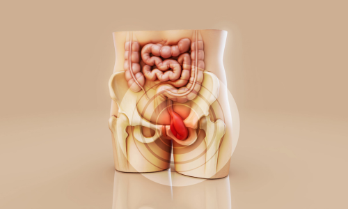 Piles Treatment